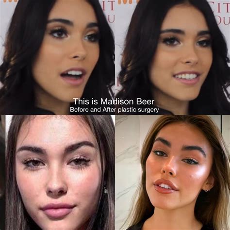 madison beer before plastic|Madison Beer Transformation: See Photos of the。